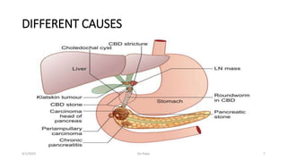 DIFFERENT CAUSES
9/1/2023 De Pope 7
 