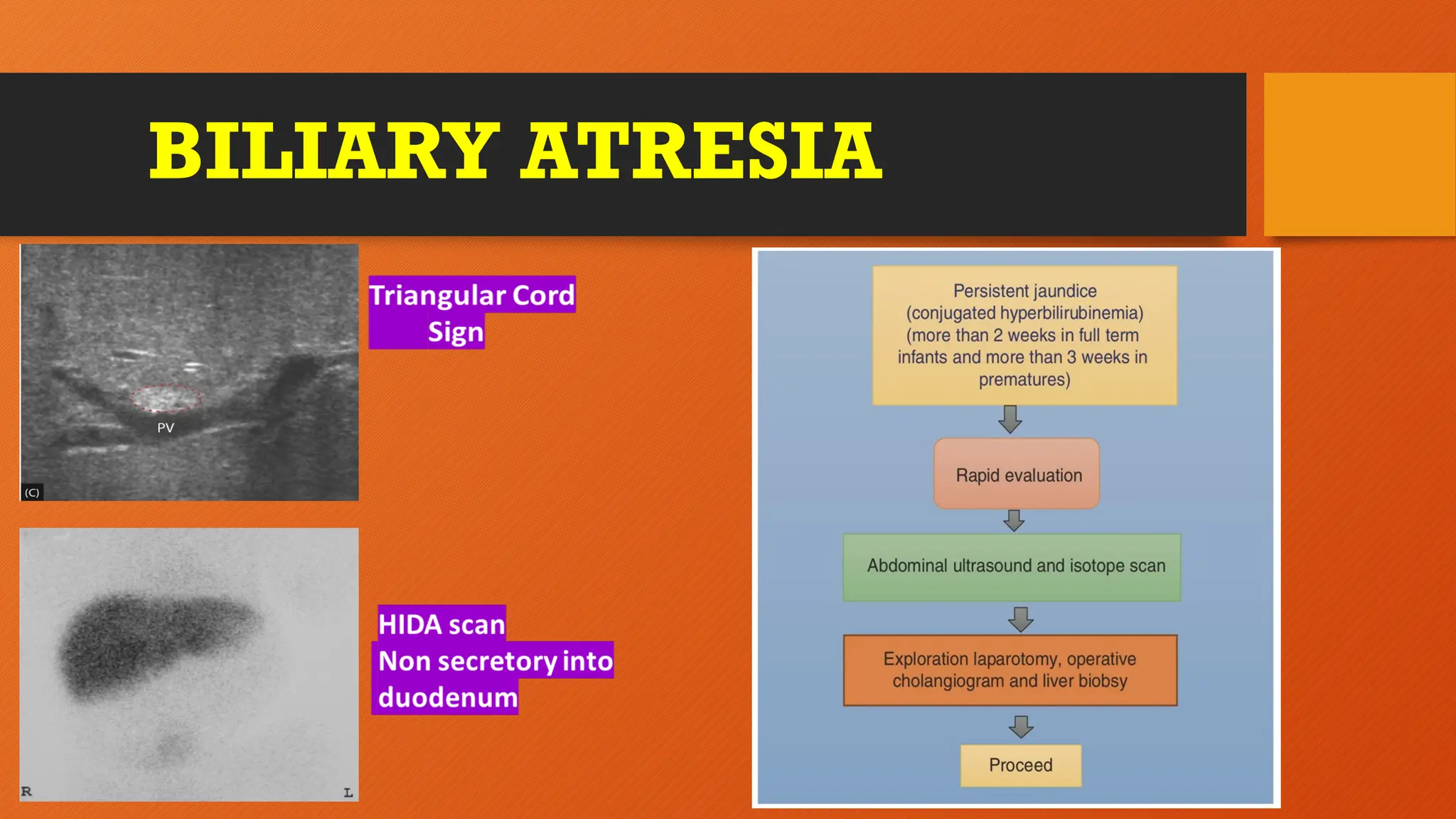 BILIARY ATRESIA
 