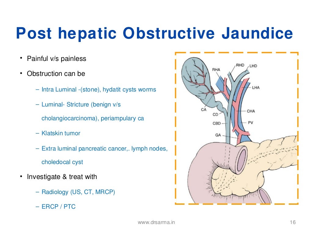 Obstructive jaundice (1)