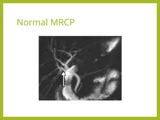 Mrcp Example Image Normal Radiological approach to obstructive Jaundice.pptx
