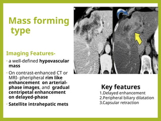 Radiological approach to obstructive Jaundice.pptx