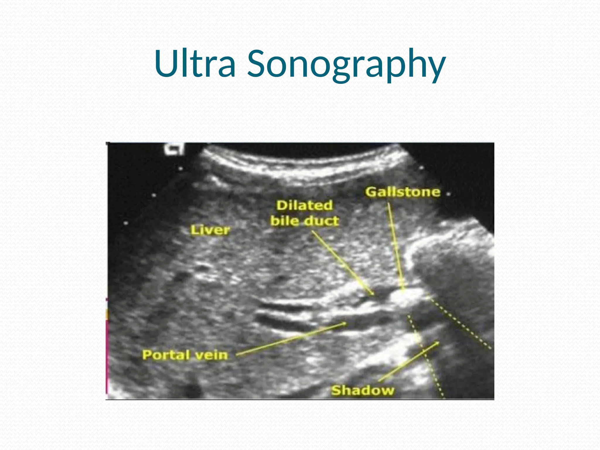 Ultra Sonography
 