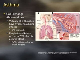 Gas Exchange
Abnormalities
Virtually all asthmatics
have hypoxemia during
attacks
V/Q mismatch
Respiratory alkalosis
occurs in 75% of acute
asthma attacks
PaCO2 will normalize as
attack worsens
Rodriguez-Roisin R. Acute Severe Asthma: Pathophysiology and Pathobiology of
Gas Exhange Abnormalities. Eur Respir J. 1997;10:1359-1371.
 
