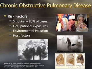 Risk Factors
Smoking – 80% of cases
Occupational exposures
Environmental Pollution
Host factors
Rabe KF, et al. Global Strategy for Diagnosis, Management, and
Prevention of Chronic Obstructive Pulmonary Disease: GOLD Executive
Summary. AM J Respir Crit Care Med. 2007;176:532-555.
 