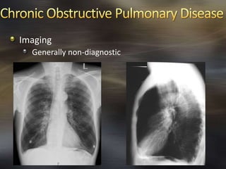 Imaging
Generally non-diagnostic
 