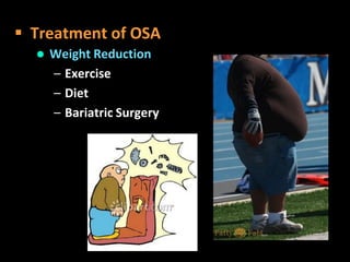  Weight Reduction
– Exercise
– Diet
– Bariatric Surgery
 Treatment of OSA
 