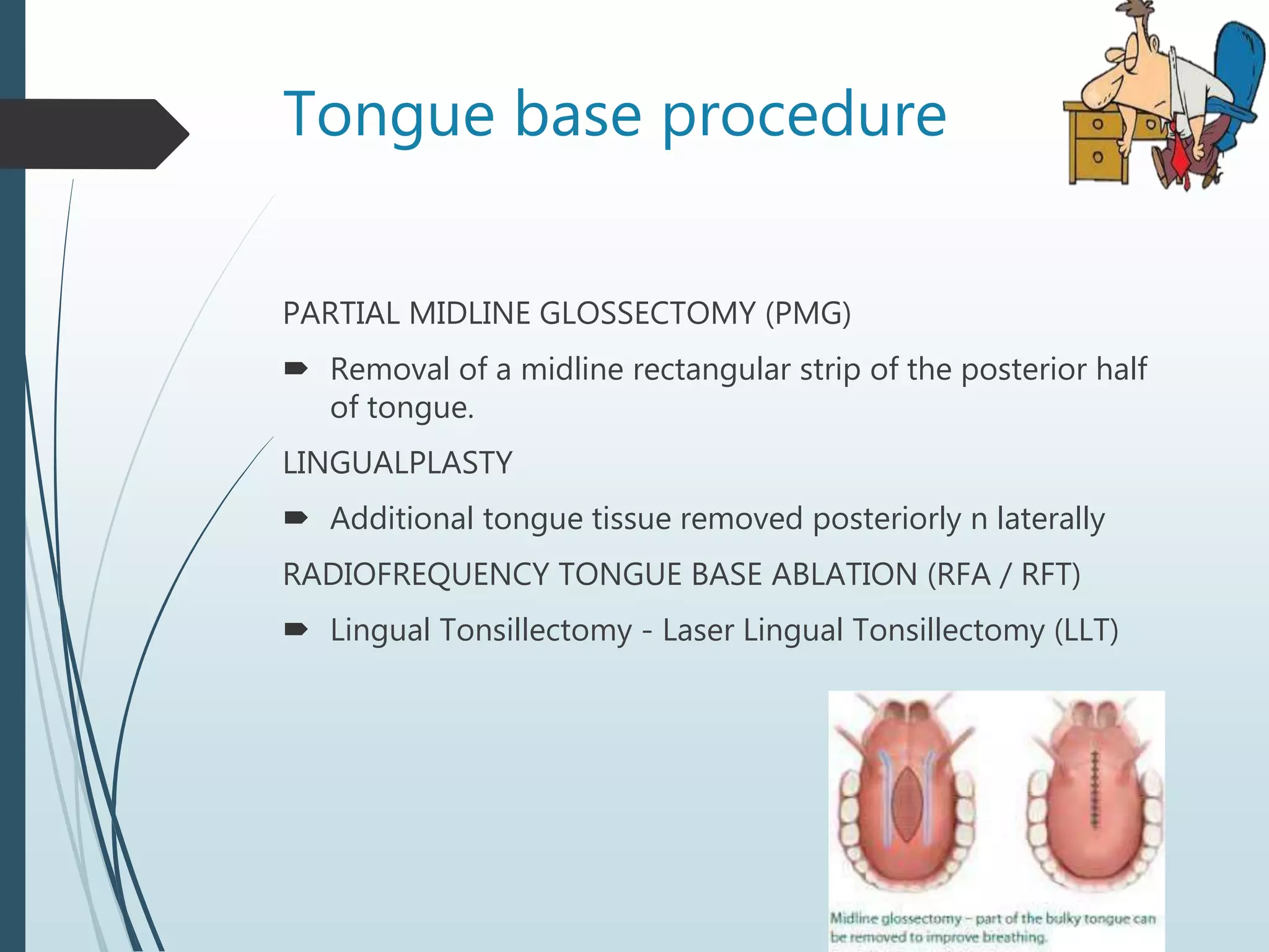 Tongue base procedure
PARTIAL MIDLINE GLOSSECTOMY (PMG)
 Removal of a midline rectangular strip of the posterior half
of tongue.
LINGUALPLASTY
 Additional tongue tissue removed posteriorly n laterally
RADIOFREQUENCY TONGUE BASE ABLATION (RFA / RFT)
 Lingual Tonsillectomy - Laser Lingual Tonsillectomy (LLT)
 