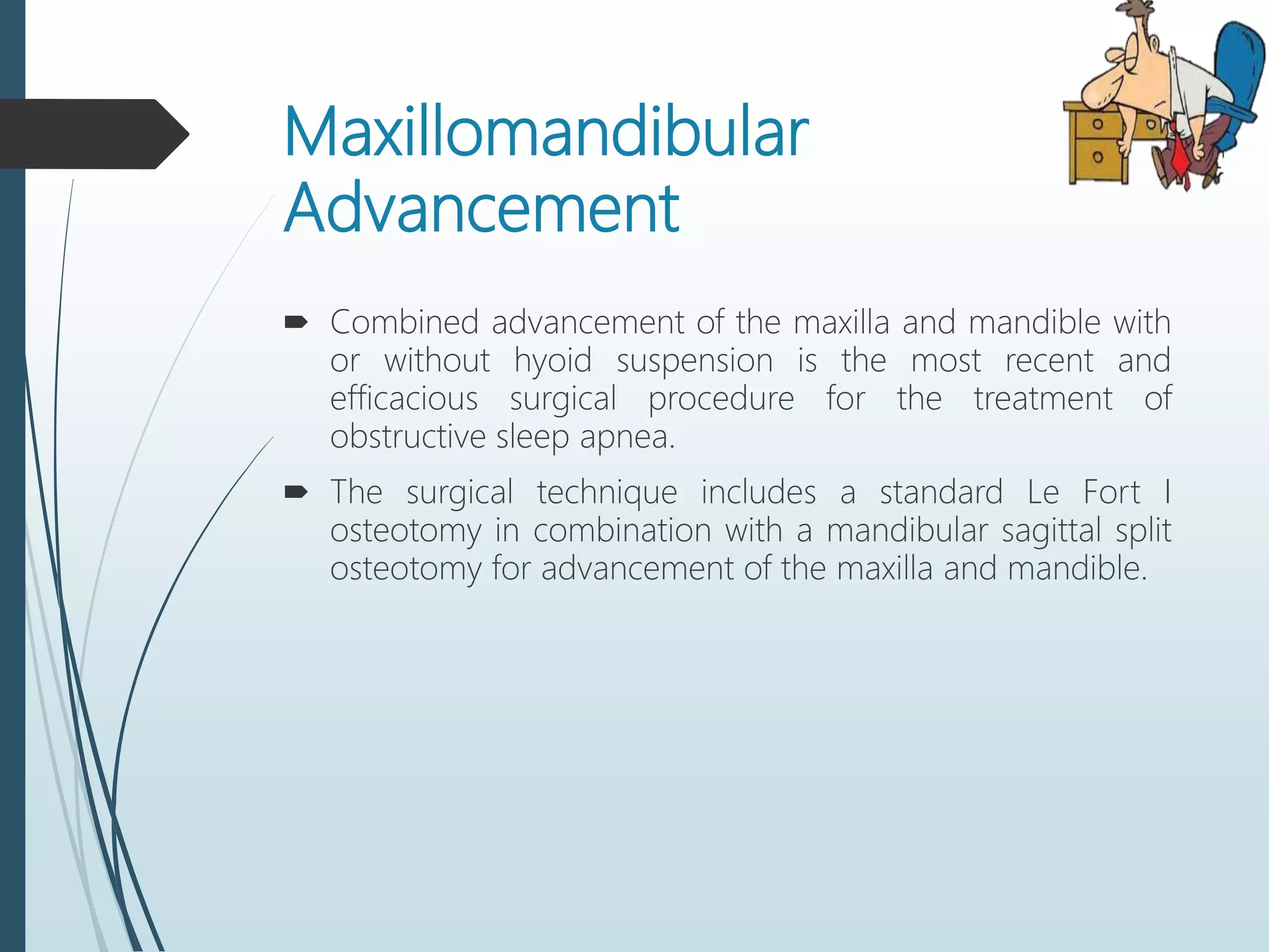 Maxillomandibular
Advancement
 Combined advancement of the maxilla and mandible with
or without hyoid suspension is the most recent and
efficacious surgical procedure for the treatment of
obstructive sleep apnea.
 The surgical technique includes a standard Le Fort I
osteotomy in combination with a mandibular sagittal split
osteotomy for advancement of the maxilla and mandible.
 