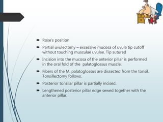 Obstructive sleep apnea | PPTX