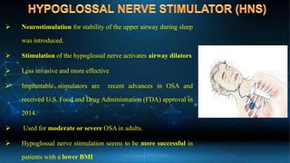 Obstructive sleep apnea | PDF