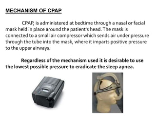 OBSTRUCTIVE SLEEP APNEA.ppt