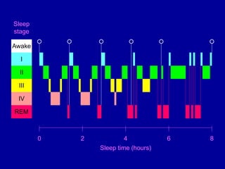 I
II
III
IV
REM
Awake
2
0 4 6 8
Sleep time (hours)
Sleep
stage
 