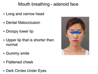 Mouth breathing - adenoid face
 Long and narrow head
 Dental Malocclusion
 Droopy lower lip
 Upper lip that is shorter then
normal
 Gummy smile
 Flattened cheek
 Dark Circles Under Eyes
 