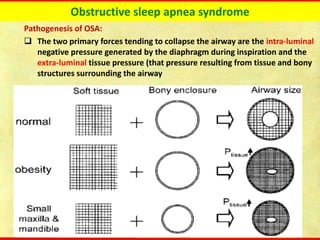 Obstructive sleep apnea syndrome
Pathogenesis of OSA:
❑ The two primary forces tending to collapse the airway are the intra-luminal
negative pressure generated by the diaphragm during inspiration and the
extra-luminal tissue pressure (that pressure resulting from tissue and bony
structures surrounding the airway
 