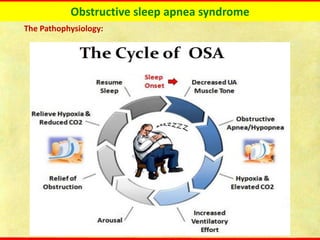 Obstructive sleep apnea syndrome
The Pathophysiology:
 