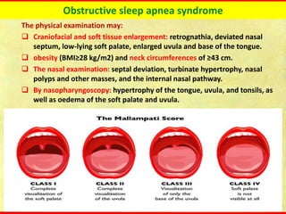 Obstructive sleep apnea syndrome
The physical examination may:
❑ Craniofacial and soft tissue enlargement: retrognathia, deviated nasal
septum, low-lying soft palate, enlarged uvula and base of the tongue.
❑ obesity (BMI≥28 kg/m2) and neck circumferences of ≥43 cm.
❑ The nasal examination: septal deviation, turbinate hypertrophy, nasal
polyps and other masses, and the internal nasal pathway.
❑ By nasopharyngoscopy: hypertrophy of the tongue, uvula, and tonsils, as
well as oedema of the soft palate and uvula.
 