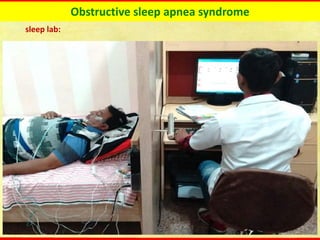 Obstructive sleep apnea syndrome
sleep lab:
 