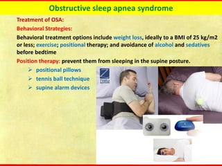 Obstructive sleep apnea syndrome
Treatment of OSA:
Behavioral Strategies:
Behavioral treatment options include weight loss, ideally to a BMI of 25 kg/m2
or less; exercise; positional therapy; and avoidance of alcohol and sedatives
before bedtime
Position therapy: prevent them from sleeping in the supine posture.
➢ positional pillows
➢ tennis ball technique
➢ supine alarm devices
 