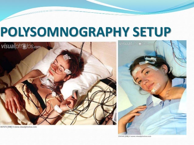 sleep apnoea obstructive sleep apnoea sleep apnoea obstructive sleep apnoea