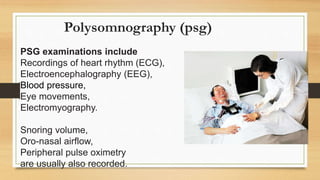 Polysomnography (psg)
PSG examinations include
Recordings of heart rhythm (ECG),
Electroencephalography (EEG),
Blood pressure,
Eye movements,
Electromyography.
Snoring volume,
Oro-nasal airflow,
Peripheral pulse oximetry
are usually also recorded.
 