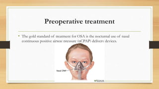 Preoperative treatment
• The gold standard of treatment for OSA is the nocturnal use of nasal
continuous positive airway pressure (nCPAP) delivery devices.
 