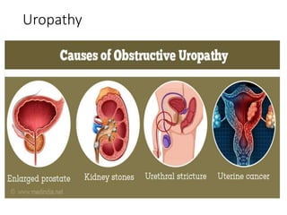 Uropathy