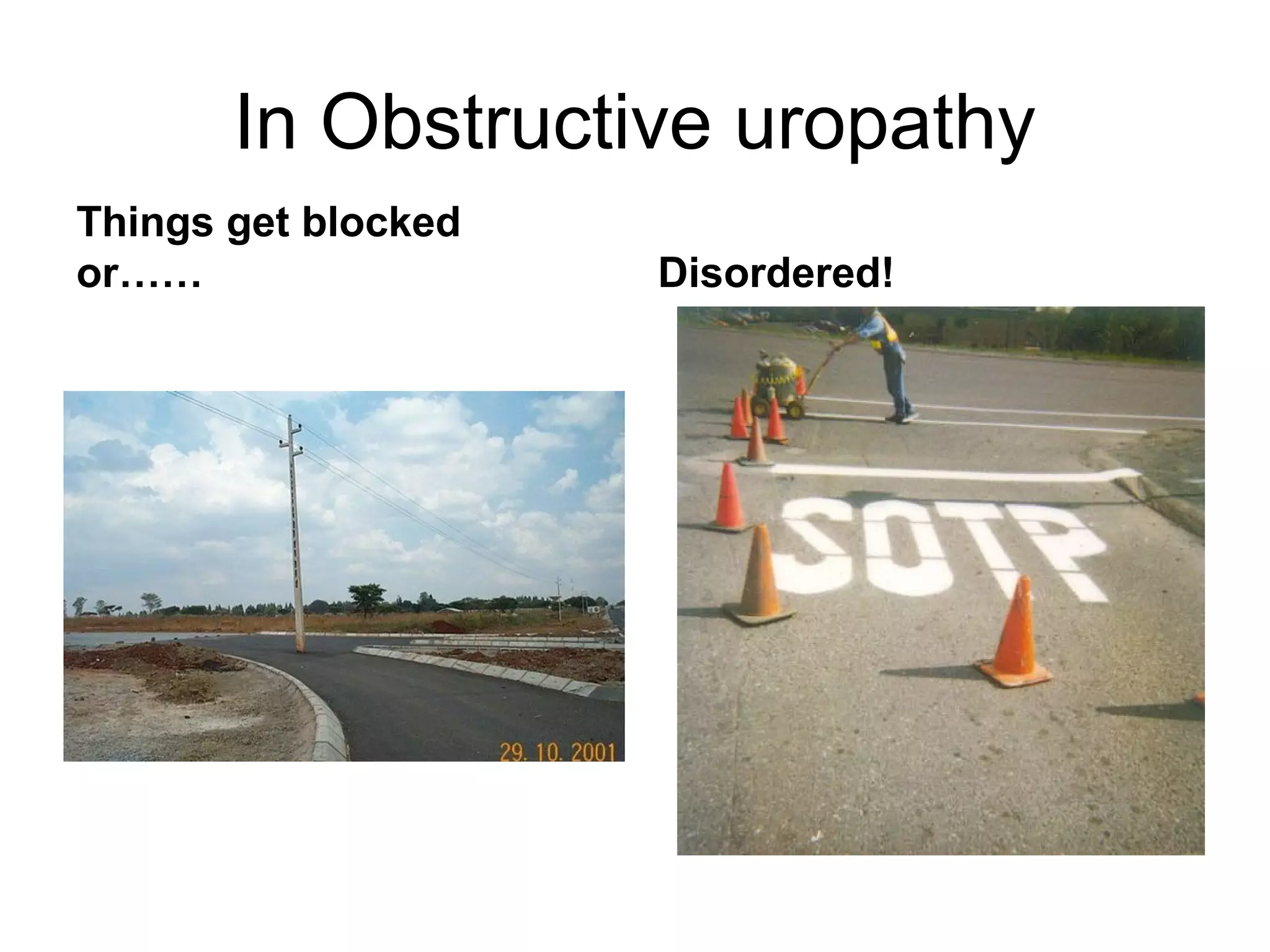 In Obstructive uropathy
Things get blocked
or…… Disordered!
 