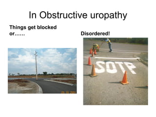 In Obstructive uropathy
Things get blocked
or…… Disordered!
 