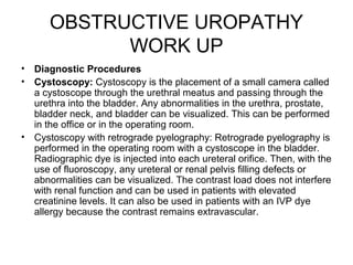 OBSTRUCTIVE UROPATHY
WORK UP
• Diagnostic Procedures
• Cystoscopy: Cystoscopy is the placement of a small camera called
a cystoscope through the urethral meatus and passing through the
urethra into the bladder. Any abnormalities in the urethra, prostate,
bladder neck, and bladder can be visualized. This can be performed
in the office or in the operating room.
• Cystoscopy with retrograde pyelography: Retrograde pyelography is
performed in the operating room with a cystoscope in the bladder.
Radiographic dye is injected into each ureteral orifice. Then, with the
use of fluoroscopy, any ureteral or renal pelvis filling defects or
abnormalities can be visualized. The contrast load does not interfere
with renal function and can be used in patients with elevated
creatinine levels. It can also be used in patients with an IVP dye
allergy because the contrast remains extravascular.
 
