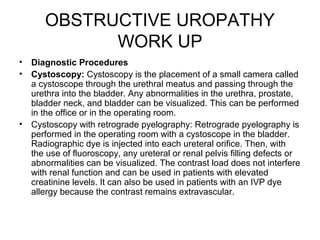 OBSTRUCTIVE UROPATHY
WORK UP
• Diagnostic Procedures
• Cystoscopy: Cystoscopy is the placement of a small camera called
a cystoscope through the urethral meatus and passing through the
urethra into the bladder. Any abnormalities in the urethra, prostate,
bladder neck, and bladder can be visualized. This can be performed
in the office or in the operating room.
• Cystoscopy with retrograde pyelography: Retrograde pyelography is
performed in the operating room with a cystoscope in the bladder.
Radiographic dye is injected into each ureteral orifice. Then, with
the use of fluoroscopy, any ureteral or renal pelvis filling defects or
abnormalities can be visualized. The contrast load does not interfere
with renal function and can be used in patients with elevated
creatinine levels. It can also be used in patients with an IVP dye
allergy because the contrast remains extravascular.
 