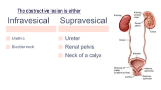 The obstructive lesion is either
Infravesical
Urethra
Bladder neck
Supravesical
Ureter
Renal pelvis
Neck of a calyx
 