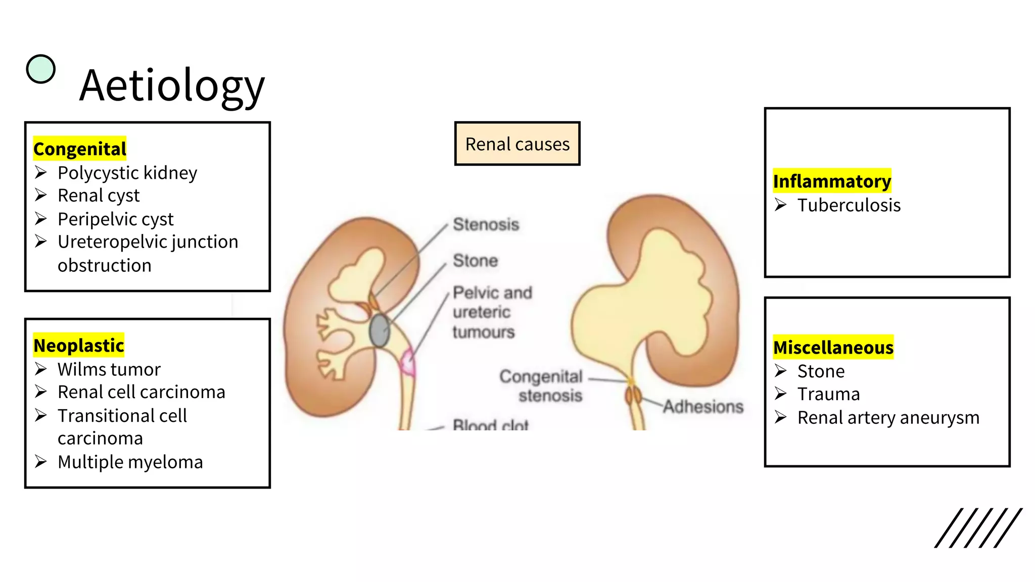 Aetiology
Renal causes
Congenital
Ø Polycystic kidney
Ø Renal cyst
Ø Peripelvic cyst
Ø Ureteropelvic junction
obstruction
Neoplastic
Ø Wilms tumor
Ø Renal cell carcinoma
Ø Transitional cell
carcinoma
Ø Multiple myeloma
Miscellaneous
Ø Stone
Ø Trauma
Ø Renal artery aneurysm
Inflammatory
Ø Tuberculosis
 