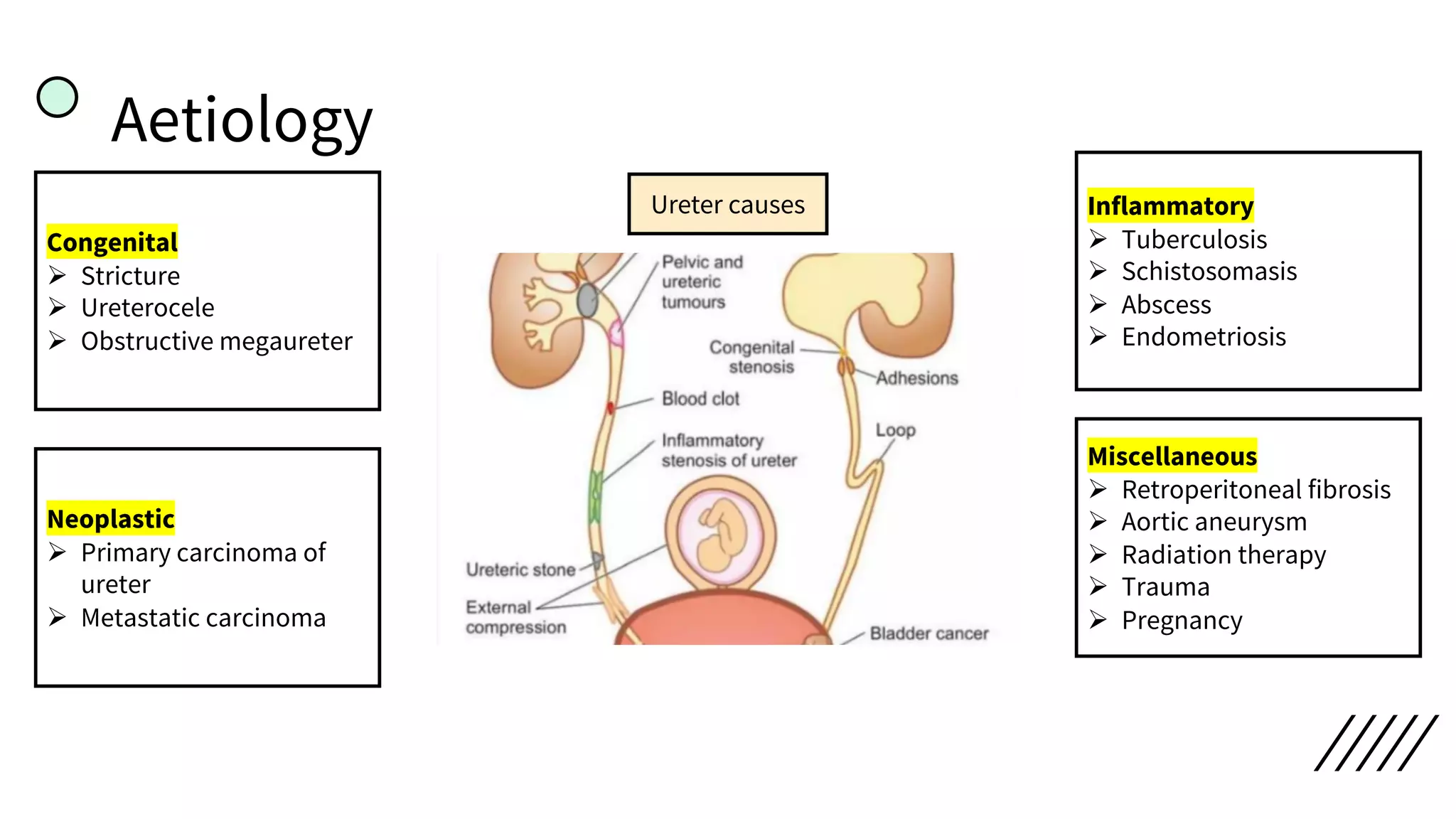 Aetiology
Ureter causes
Congenital
Ø Stricture
Ø Ureterocele
Ø Obstructive megaureter
Neoplastic
Ø Primary carcinoma of
ureter
Ø Metastatic carcinoma
Miscellaneous
Ø Retroperitoneal fibrosis
Ø Aortic aneurysm
Ø Radiation therapy
Ø Trauma
Ø Pregnancy
Inflammatory
Ø Tuberculosis
Ø Schistosomasis
Ø Abscess
Ø Endometriosis
 