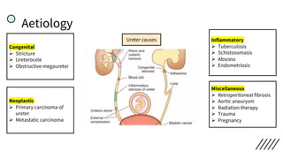 Aetiology
Ureter causes
Congenital
Ø Stricture
Ø Ureterocele
Ø Obstructive megaureter
Neoplastic
Ø Primary carcinoma of
ureter
Ø Metastatic carcinoma
Miscellaneous
Ø Retroperitoneal fibrosis
Ø Aortic aneurysm
Ø Radiation therapy
Ø Trauma
Ø Pregnancy
Inflammatory
Ø Tuberculosis
Ø Schistosomasis
Ø Abscess
Ø Endometriosis
 