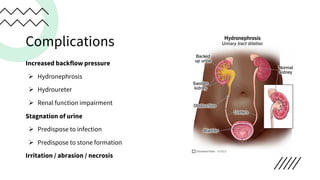 Complications
Increased backflow pressure
Ø Hydronephrosis
Ø Hydroureter
Ø Renal function impairment
Stagnation of urine
Ø Predispose to infection
Ø Predispose to stone formation
Irritation / abrasion / necrosis
 
