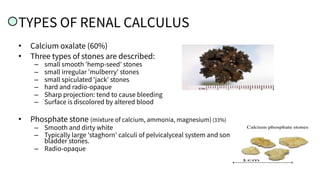 TYPES OF RENAL CALCULUS
• Calcium oxalate (60%)
• Three types of stones are described:
– small smooth 'hemp-seed' stones
– small irregular 'mulberry' stones
– small spiculated 'jack' stones
– hard and radio-opaque
– Sharp projection: tend to cause bleeding
– Surface is discolored by altered blood
• Phosphate stone (mixture of calcium, ammonia, magnesium) (33%)
– Smooth and dirty white
– Typically large 'staghorn' calculi of pelvicalyceal system and some
bladder stones.
– Radio-opaque
 