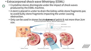• Extracorporeal shock wave lithotripsy (ESWL)
• Crystalline stones disintegrate under the impact of shock waves
produced by the ESWL machine.
• A stent is placed in ureter to drain the kidney while stone fragments pas
to avoid bulky stone fragments impacting the ureter causing
obstruction.
• Only can be used in stones located at renal pelvis & not more than 2cm
size.
 