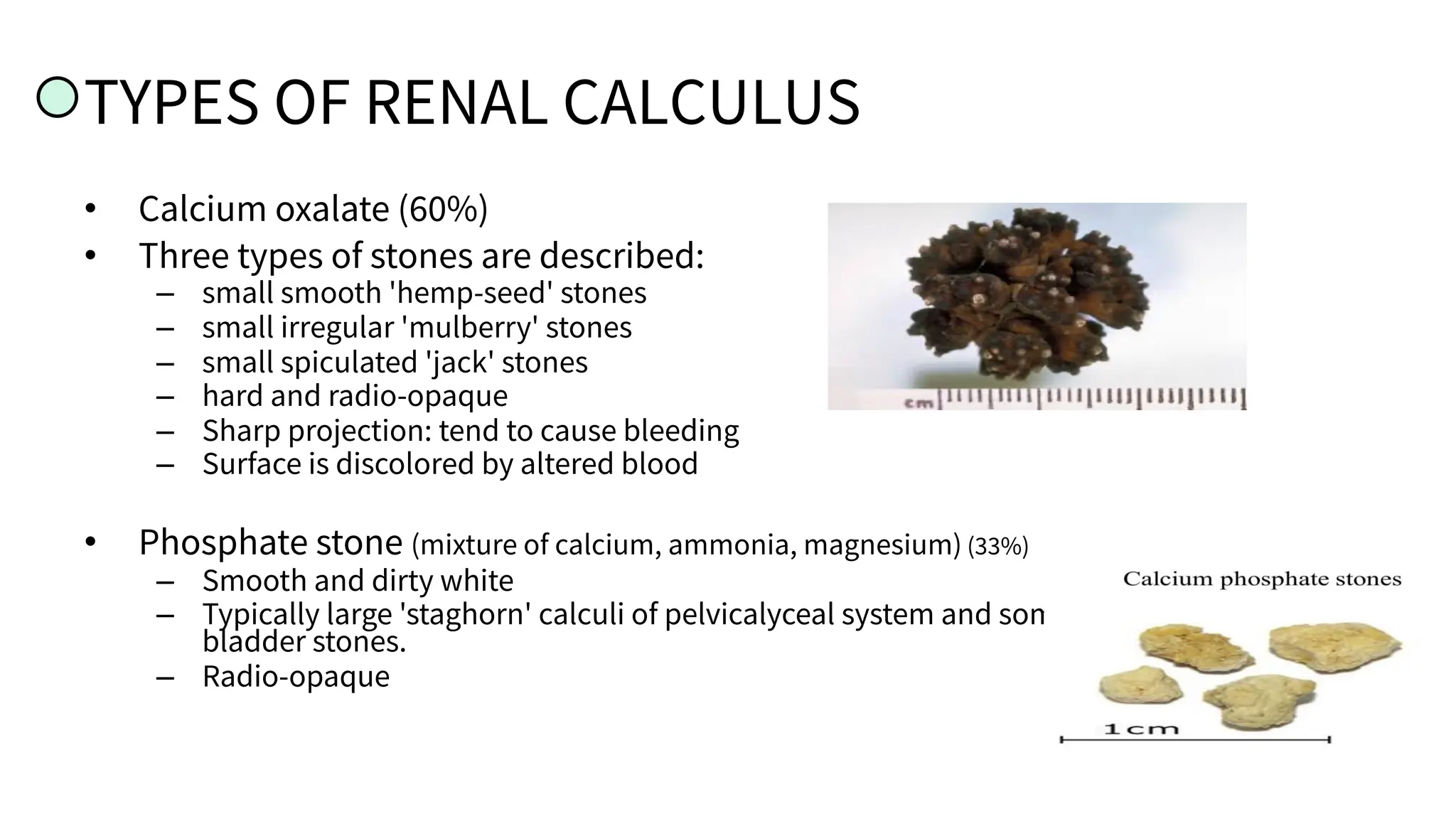 TYPES OF RENAL CALCULUS
• Calcium oxalate (60%)
• Three types of stones are described:
– small smooth 'hemp-seed' stones
– small irregular 'mulberry' stones
– small spiculated 'jack' stones
– hard and radio-opaque
– Sharp projection: tend to cause bleeding
– Surface is discolored by altered blood
• Phosphate stone (mixture of calcium, ammonia, magnesium) (33%)
– Smooth and dirty white
– Typically large 'staghorn' calculi of pelvicalyceal system and some
bladder stones.
– Radio-opaque
 