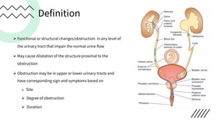 Definition
Ø Functional or structural changes/obstruction in any level of
the urinary tract that impair the normal urine flow
Ø May cause dilatation of the structure proximal to the
obstruction
Ø Obstruction may be in upper or lower urinary tracts and
have corresponding sign and symptoms based on
Ø ́Site
Ø Degree of obstruction
Ø Duration
 
