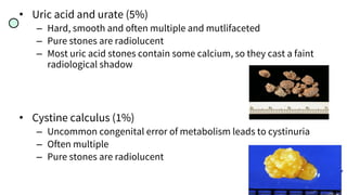 • Uric acid and urate (5%)
– Hard, smooth and often multiple and mutlifaceted
– Pure stones are radiolucent
– Most uric acid stones contain some calcium, so they cast a faint
radiological shadow
• Cystine calculus (1%)
– Uncommon congenital error of metabolism leads to cystinuria
– Often multiple
– Pure stones are radiolucent
 