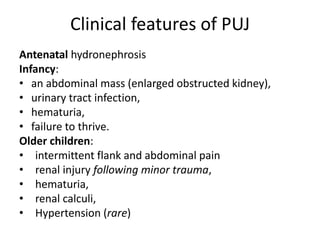 Clinical features of PUJ
Antenatal hydronephrosis
Infancy:
• an abdominal mass (enlarged obstructed kidney),
• urinary tract infection,
• hematuria,
• failure to thrive.
Older children:
• intermittent flank and abdominal pain
• renal injury following minor trauma,
• hematuria,
• renal calculi,
• Hypertension (rare)
 