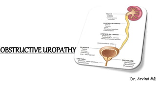 OBSTRUCTIVE UROPATHY
Dr. Arvind MD
 