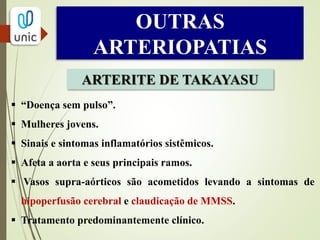 OUTRAS
ARTERIOPATIAS
ARTERITE TEMPORAL
• Arterite de células gigantes.
• + Mulheres > 50 anos de idade.
• Acomete mais artéria temporal superficial.
• Claudicação dos músculos faciais ou extremidades,
cefaleia, isquemia retiniana e amaurose.
 