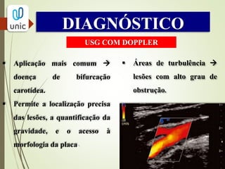 DIAGNÓSTICO
ANGIOGRAFIA
 Permitiu a localização anatômica de aneurismas e das lesões
oclusivas.
 Injeção de meio de contraste e obtenção das imagens
radiológicas.
 