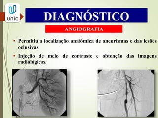 INTERVENÇÕES
TERAPÊUTICAS
 Hipolipemiantes
 Antiagregantes plaquetários
 Trombolíticos
 Revascularização com enxertos
homólogos ou sintéticos
 Endarterectomia
 Angioplastia por balão ou por stent
 