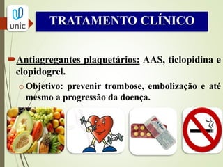 TRATAMENTO TROMBOLÍTICO
Medicamentos fibrinolíticos  aumentam a conversão do
plasminogênio em plasmina que degrada a fibrina do
coágulo.
 Utilizada nos eventos embólicos agudos ou como auxiliar
das intervenções cirúrgicas.
 Substâncias utilizadas: urocinase e ativador do
plasminogênio tissular.
 Administração sistêmica ou infusão direta dentro do
coágulo.
 Anticoagulação durante o procedimento, para evitar
formação de novos coágulos.
 