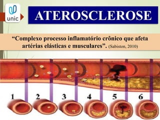 ATEROSCLEROSE
“Complexo processo inflamatório crônico que afeta
artérias elásticas e musculares”. (Sabiston, 2010)
 