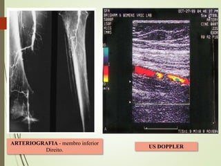 ANGIORESSONÂNCIA MAGNÉTICA
 
