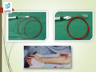 TRATAMENTO
OCLUSÃO TROMBÓTICA
- Arteriografia inicial- delimitar a anatomia e definir
melhor técnica de revascularização;
- Revascularização através de pontes cirúrgicas →
quando o segmento de oclusão é longo;
- Recanalização do vaso por terapia trombolítica por
cateter + angioplastia com balão → quando o
segmento de oclusão é curto.
 