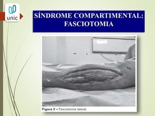 GUYTON & HALL. Tratado de Fisiologia Médica. 12 ed. Rio de Janeiro: Elsevier,
2011.
 SABISTON JR., David C.; TOWNSEND, Courtney M et al. Sabiston tratado de
cirurgia: a base biológica da prática cirúrgica moderna. 18. ed. Rio de Janeiro:
Elsevier, 2010.
 SILVA JÚNIOR, O.F.; PITTA, B.B.B. Oclusão Arterial Aguda. Pitta GBB,
Castro AA, Burihan E, editores. Angiologia e cirurgia vascular: guia ilustrado.Maceió:
UNCISAL/ECMAL & LAVA; 2003. Disponível em: <http://www.lava.med.br/livro>
Acesso em 25 de abr. 2014.
REFERÊNCIAS BIBLIOGRÁFICAS
 